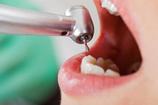 Best Cracked Tooth Emergency Dentist  in Ack, NY